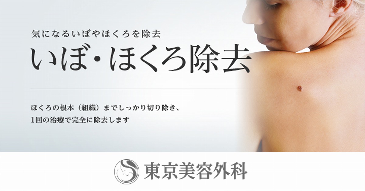 仙台市 ほくろのレーザー治療でおすすめ美容クリニック ほくろのレーザー治療の料金 評判比較 キレカワ